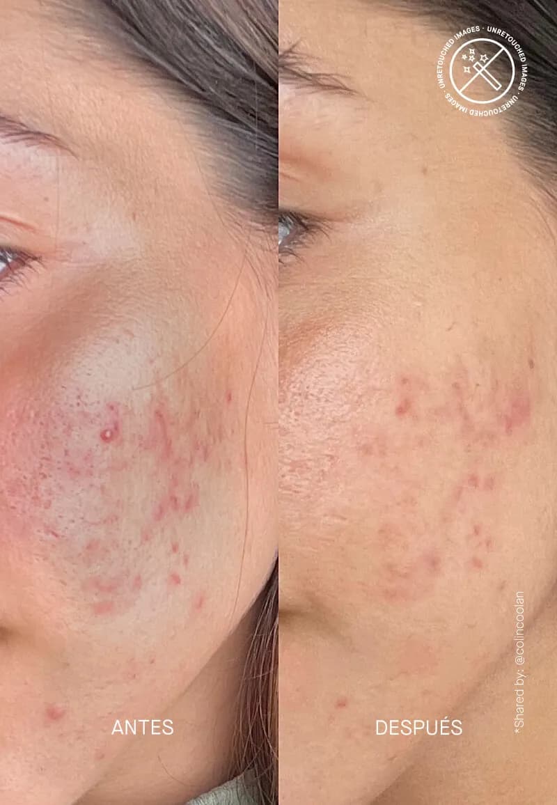 THERAMID Azid 30ml 4